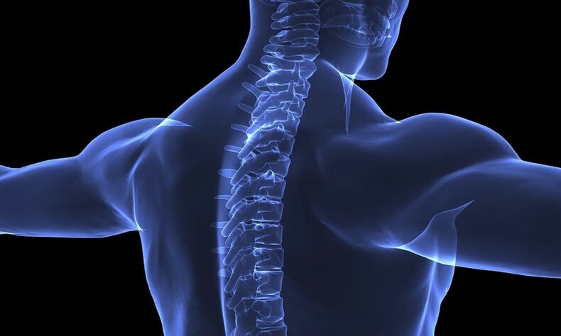 Osteochondrose der Halswirbelsäule kann zu vegetativer Gefäßdystonie führen