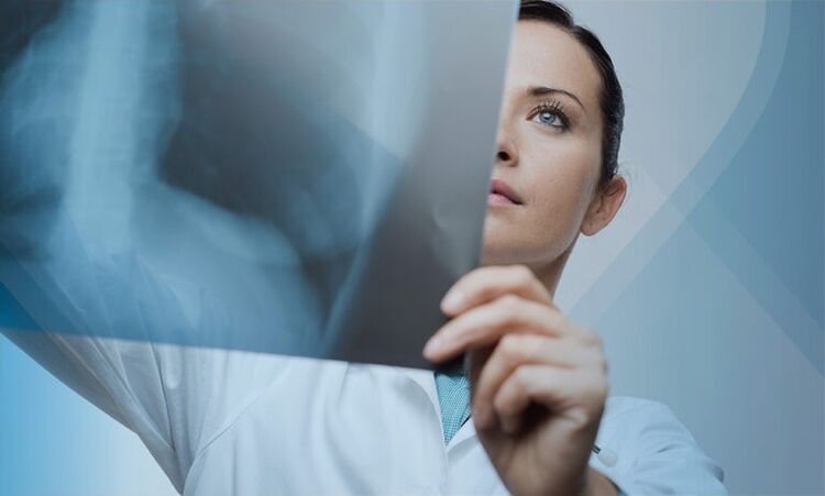 Ein Arzt untersucht eine Momentaufnahme der Halswirbelsäule mit Osteochondrose