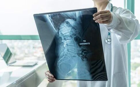 Die Radiographie ist eine notwendige diagnostische Methode, wenn Ihr Rücken schmerzt. 